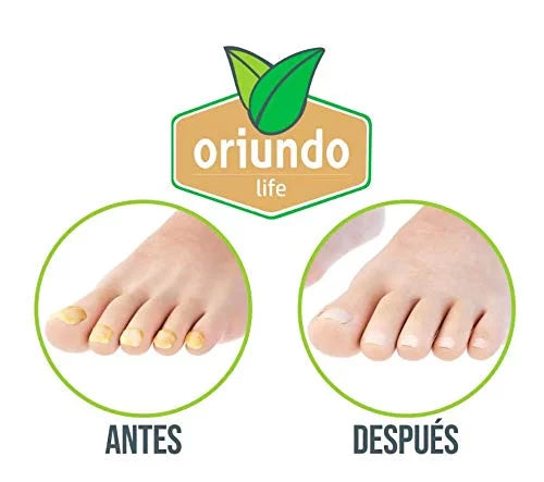 Oriundo Life Nail Treatment, Tratamiento Para Uñas, Extra Strength Nail Rebrand newal, Made in USA